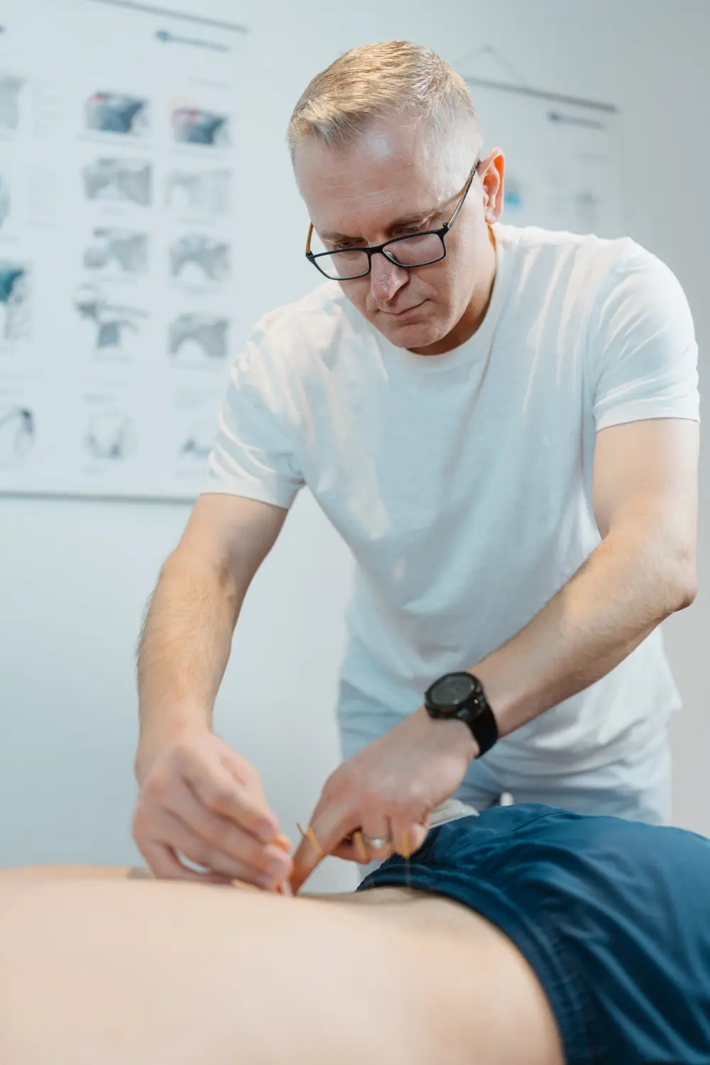 Metush Qorrolli behandelt den unteren Rücken einer Patientin mit Akupunktur